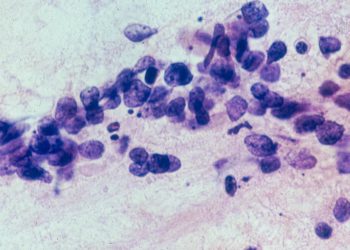 Seagen-veteraanien Johtama ja Kiinassa Sekä Seattlessa Sijaitseva ProfoundBio Keräsi 55 Miljoonaa Dollaria